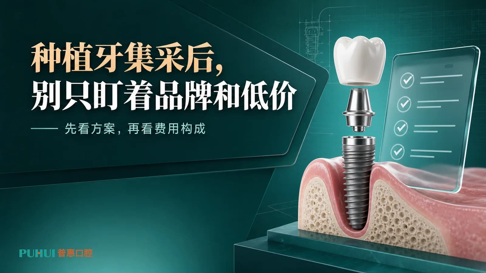 种植牙集采后,应该怎么选?别只盯着品牌和低价科普封面